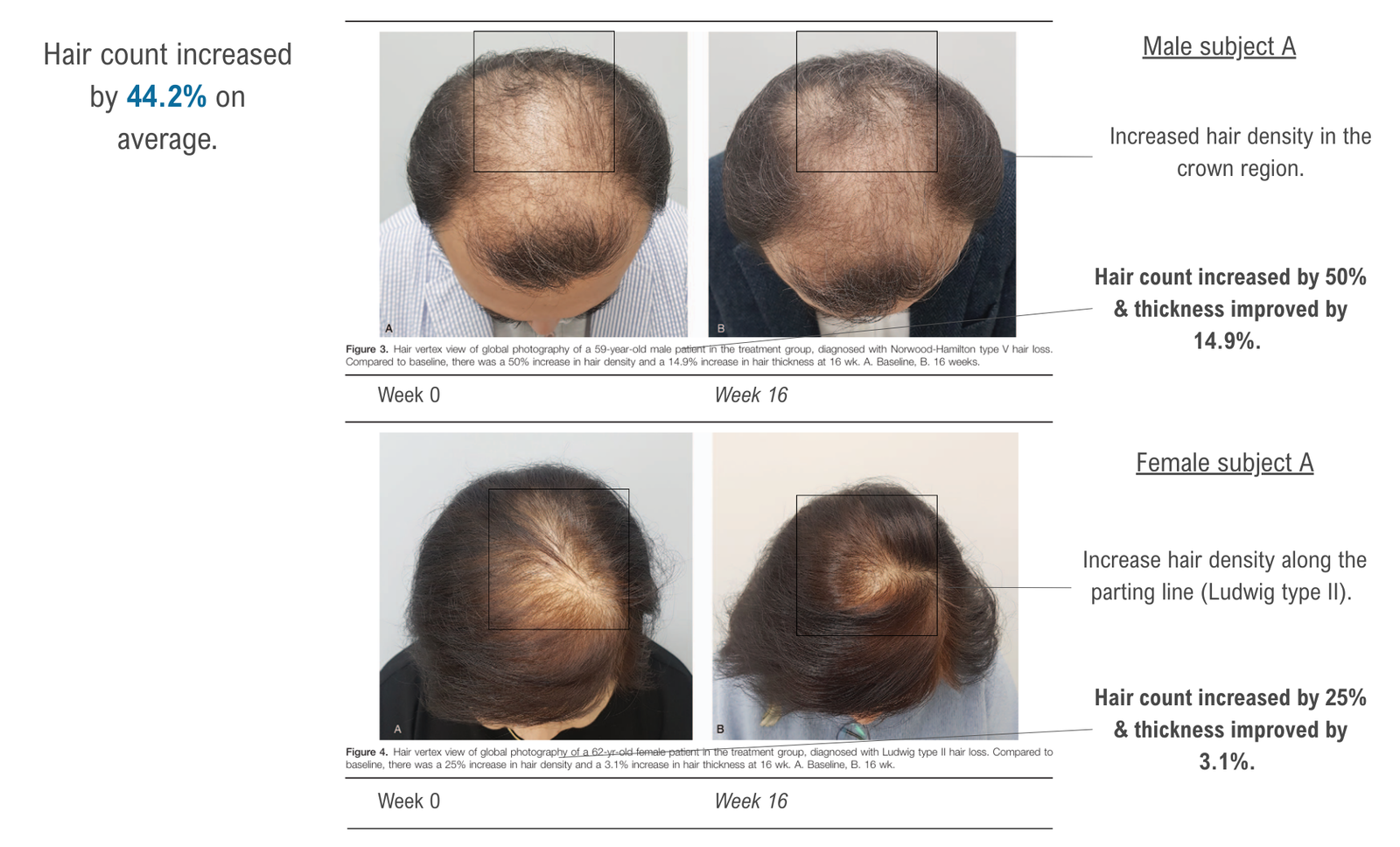 before and after 3